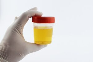 Blog Post Title is Mycotoxin Testing: 10 Warning Signs of Mold Toxicity. Image is of a gloved hand holding a urine test.